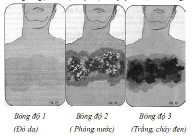 Quyết định 2919/QĐ-BYT của Bộ Y tế về việc ban hành 