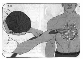 Quyết định 2919/QĐ-BYT của Bộ Y tế về việc ban hành 