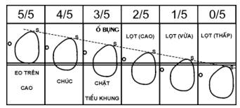 Quyết định 2919/QĐ-BYT của Bộ Y tế về việc ban hành 