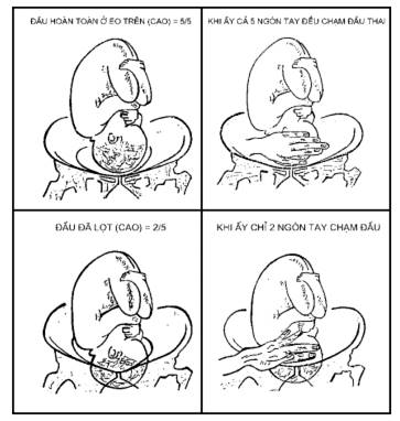 Quyết định 2919/QĐ-BYT của Bộ Y tế về việc ban hành 