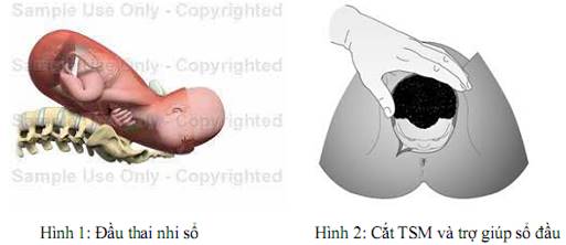 Quyết định 2919/QĐ-BYT của Bộ Y tế về việc ban hành 