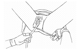 Quyết định 2919/QĐ-BYT của Bộ Y tế về việc ban hành 