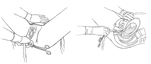 Quyết định 2919/QĐ-BYT của Bộ Y tế về việc ban hành 