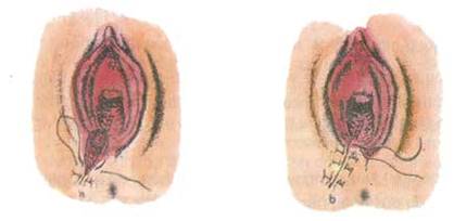 Quyết định 2919/QĐ-BYT của Bộ Y tế về việc ban hành 