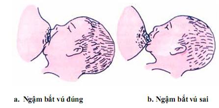 Quyết định 2919/QĐ-BYT của Bộ Y tế về việc ban hành 