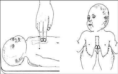 Quyết định 2919/QĐ-BYT của Bộ Y tế về việc ban hành 