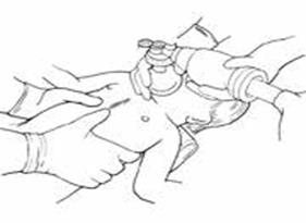 Quyết định 2919/QĐ-BYT của Bộ Y tế về việc ban hành 