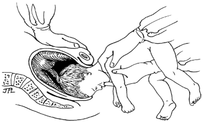 Quyết định 2919/QĐ-BYT của Bộ Y tế về việc ban hành 