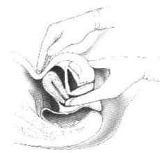 Quyết định 2919/QĐ-BYT của Bộ Y tế về việc ban hành 