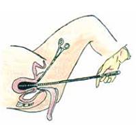 Quyết định 2919/QĐ-BYT của Bộ Y tế về việc ban hành 