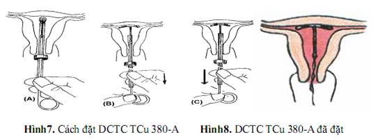 Quyết định 2919/QĐ-BYT của Bộ Y tế về việc ban hành 