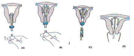 Quyết định 2919/QĐ-BYT của Bộ Y tế về việc ban hành 