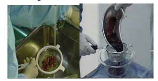 Quyết định 2919/QĐ-BYT của Bộ Y tế về việc ban hành 