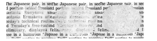 Quyết định 1314/QĐ-BYT của Bộ Y tế về việc ban hành Hướng dẫn chẩn đoán, điều trị và dự phòng bệnh lao