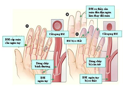 Quyết định 75/QĐ-BYT của Bộ Y tế về việc ban hành Tài liệu chuyên môn “Hướng dẫn chẩn đoán và điều trị các bệnh da liễu”
