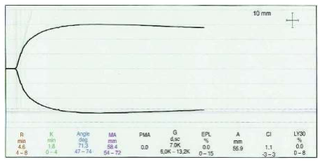 Quyết định 1832/QĐ-BYT của Bộ Y tế về việc ban hành tài liệu chuyên môn 