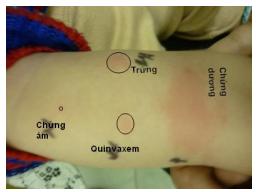 Quyết định 3942/QĐ-BYT của Bộ Y tế về việc ban hành tài liệu chuyên môn