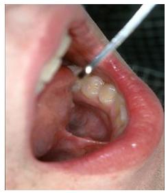 Quyết định 3942/QĐ-BYT của Bộ Y tế về việc ban hành tài liệu chuyên môn