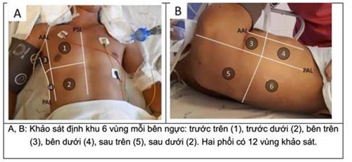 Quyết định 2671/QĐ-BYT của Bộ Y tế về việc ban hành Hướng dẫn chẩn đoán và điều trị COVID-19