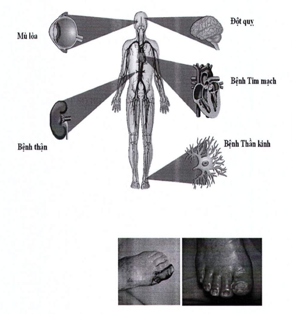 Quyết định 5904/QĐ-BYT của Bộ Y tế về việc ban hành tài liệu chuyên môn 