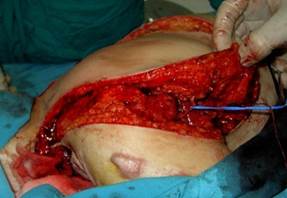 Quyết định 635/QĐ-BYT của Bộ Y tế về ban hành Hướng dẫn Quy trình kỹ thuật khám bệnh, chữa bệnh chuyên ngành Bỏng