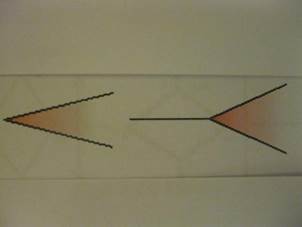 Quyết định 635/QĐ-BYT của Bộ Y tế về ban hành Hướng dẫn Quy trình kỹ thuật khám bệnh, chữa bệnh chuyên ngành Bỏng