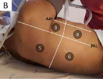 Quyết định 4689/QĐ-BYT của Bộ Y tế về việc ban hành Hướng dẫn chẩn đoán và điều trị COVID-19