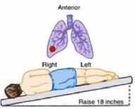 Quyết định 4689/QĐ-BYT của Bộ Y tế về việc ban hành Hướng dẫn chẩn đoán và điều trị COVID-19