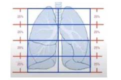 Quyết định 4689/QĐ-BYT của Bộ Y tế về việc ban hành Hướng dẫn chẩn đoán và điều trị COVID-19