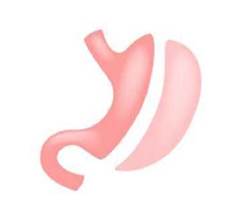 Quyết định 2892/QĐ-BYT của Bộ Y tế về việc ban hành Tài liệu chuyên môn “Hướng dẫn chẩn đoán và điều trị bệnh béo phì”