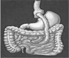 Quyết định 2892/QĐ-BYT của Bộ Y tế về việc ban hành Tài liệu chuyên môn “Hướng dẫn chẩn đoán và điều trị bệnh béo phì”