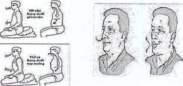 Quyết định 1719/QĐ-BYT của Bộ Y tế về việc ban hành tài liệu Hướng dẫn Phục hồi chức năng bệnh Viêm đường hô hấp cấp tính do SARS-CoV-2 (COVID-19)