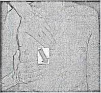 Quyết định 1719/QĐ-BYT của Bộ Y tế về việc ban hành tài liệu Hướng dẫn Phục hồi chức năng bệnh Viêm đường hô hấp cấp tính do SARS-CoV-2 (COVID-19)