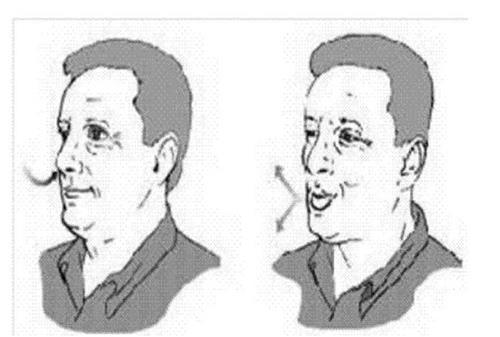 Quyết định 1773/QĐ-BYT của Bộ Y tế về việc ban hành “Sổ tay hướng dẫn một số biện pháp phòng chống dịch Viêm đường hô hấp cấp do SARS-COV-2 (COVID-19) đối với người khuyết tật tại cộng đồng”