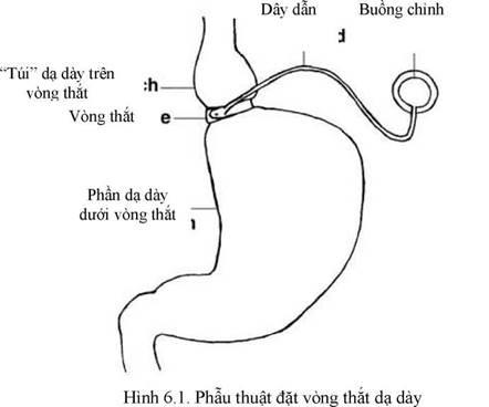 Quyết định 2892/QĐ-BYT của Bộ Y tế về việc ban hành Tài liệu chuyên môn “Hướng dẫn chẩn đoán và điều trị bệnh béo phì”