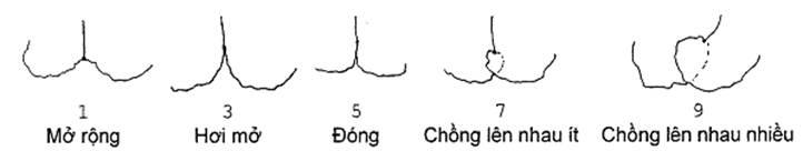 Thông tư 05/2014/TT-BNNPTNT của Bộ Nông nghiệp và Phát triển nông thôn về việc ban hành Quy chuẩn kỹ thuật quốc gia lĩnh vực trồng trọt
