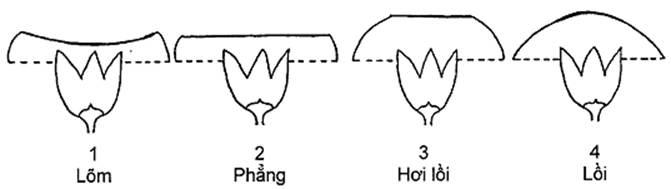 Thông tư 05/2014/TT-BNNPTNT của Bộ Nông nghiệp và Phát triển nông thôn về việc ban hành Quy chuẩn kỹ thuật quốc gia lĩnh vực trồng trọt