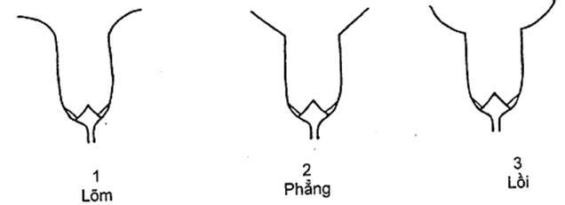 Thông tư 05/2014/TT-BNNPTNT của Bộ Nông nghiệp và Phát triển nông thôn về việc ban hành Quy chuẩn kỹ thuật quốc gia lĩnh vực trồng trọt